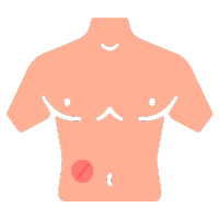 Clínica de Hernia en Comalcalco