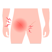 Clínica de Hernia en Comalcalco