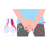 Clínica de Hernia en Comalcalco