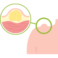 Cirujano Gastrointestinal en Comalcalco