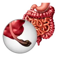 Cirujano Gastrointestinal en Comalcalco