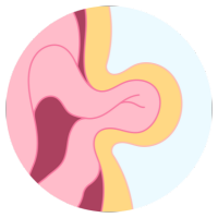 Cirujano Gastrointestinal en Comalcalco