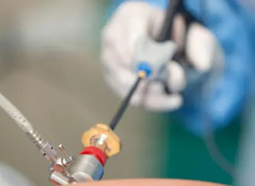 cirugia laparoscopica Servicios en Comalcalco