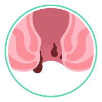 Cirujano Gastrointestinal en Comalcalco