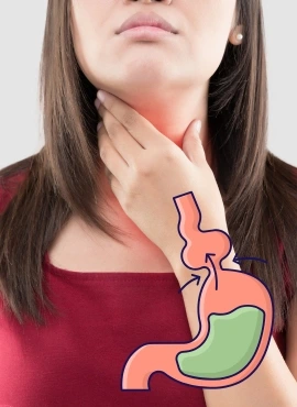 Cirugía de Hernia Hiatal en Villahermosa